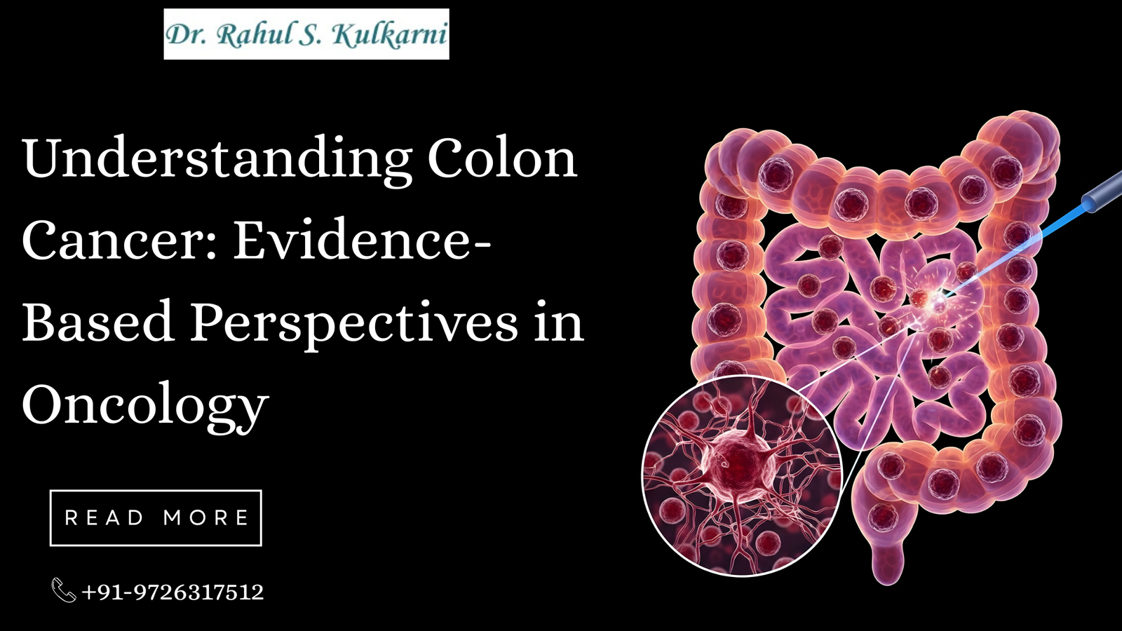 Understanding Colon Cancer: Evidence-Based Perspectives in Oncology